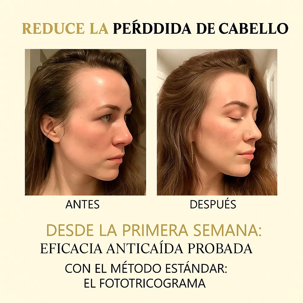 Suero Maximizador CapilRoot Pro