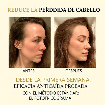 Suero Maximizador CapilRoot Pro