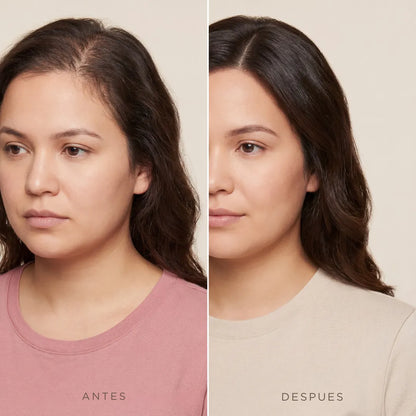 CapilRoot Pro - Recupera tu cabello y tu confianza en casa, sin químicos ni pastillas