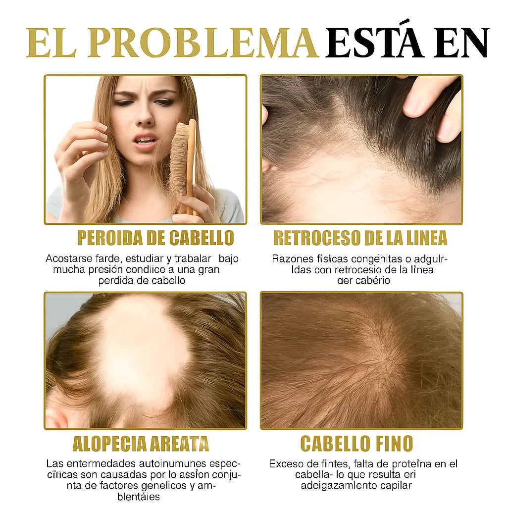 Suero Maximizador CapilRoot Pro
