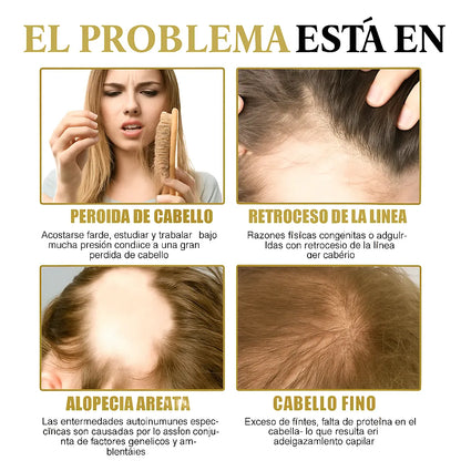 Suero Maximizador CapilRoot Pro